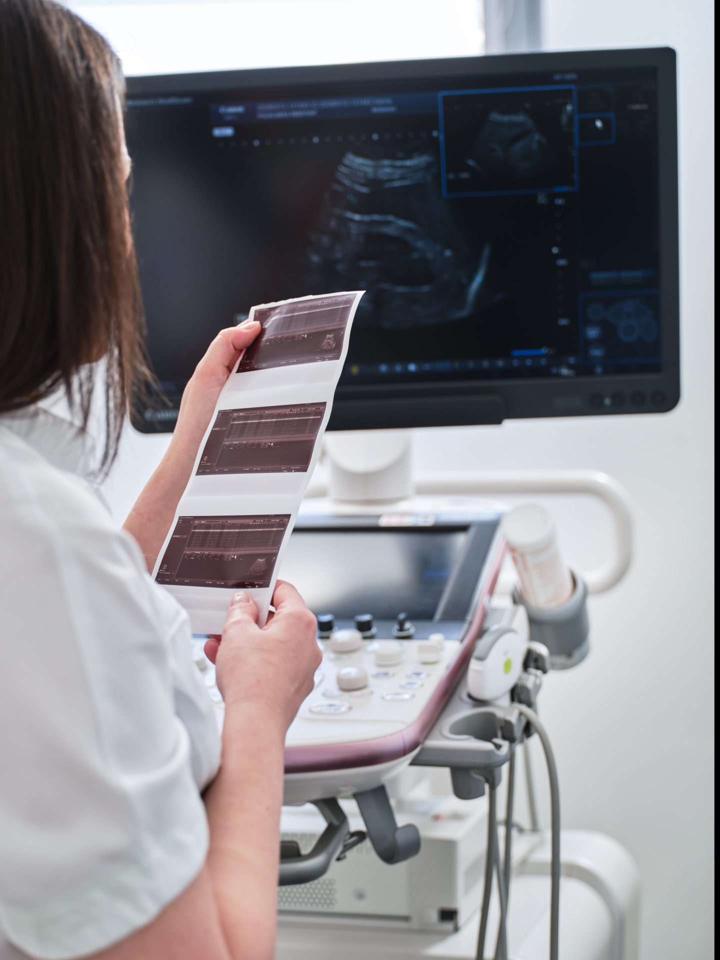 Analiza UZV nalaza Poliklinika MedPoint Split