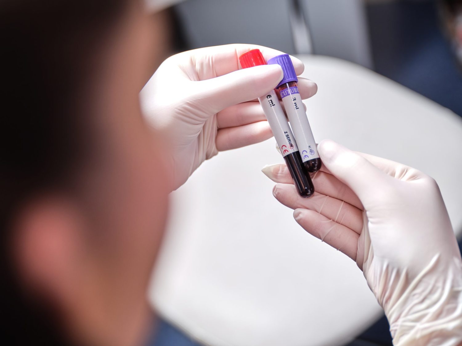 Laboratorij Poliklinike MedPoint: epruvete s uzorcima krvi, brza analiza