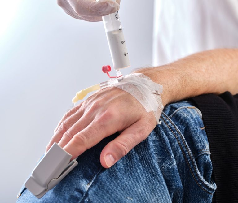 Pacijent tijekom anestezije prije kolonoskopije i gastroskopije u Poliklinici MedPoint Solin