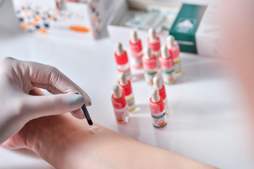 Prick test za alergološko testiranje u Poliklinici MedPoint Split