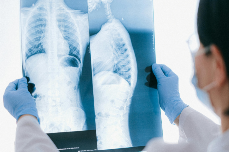 Pulmolog i alergolog u Poliklinici MedPoint za pregled pluća i respiratorne tegobe