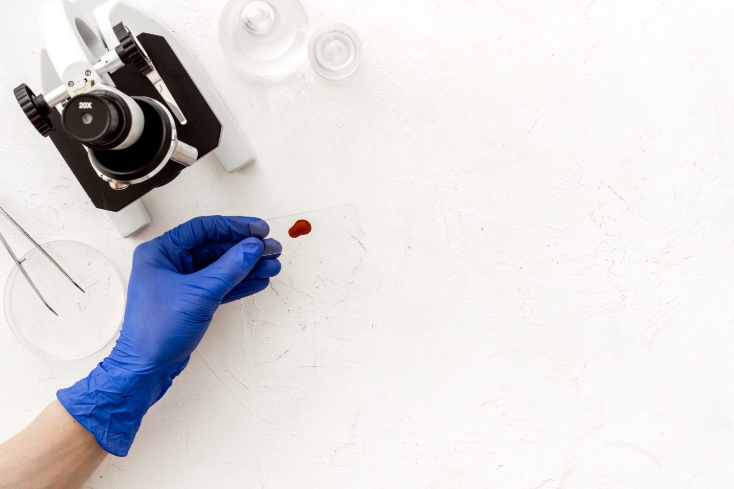 Mikroskopska analiza uzorka krvi u dijagnostici hematoloških bolesti u Poliklinici MedPoint u Solinu