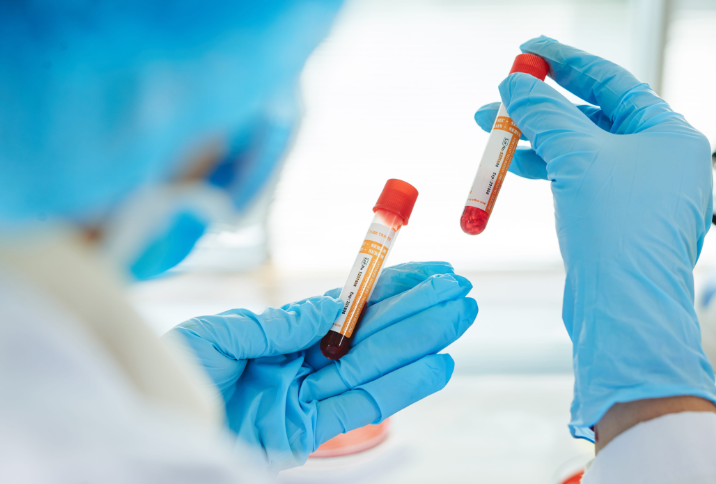 Uzorci krvi za hematološke pretrage i laboratorijsku obradu u Poliklinici MedPoint u Splitu