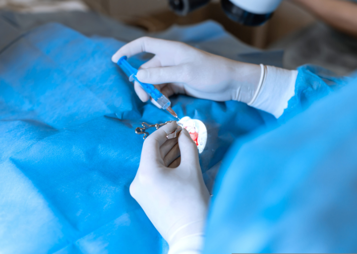 Mali kirurški zahvat u lokalnoj anesteziji u Poliklinici MedPoint u Splitu